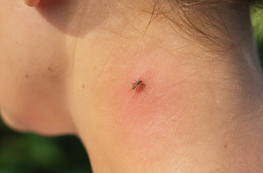Close-up of a mosquito biting human skin outdoors during summer in New Hampshire, highlighting the need for professional mosquito control services from Greater NH Pest Control in NH.